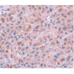 Interleukin 10 Receptor Alpha (IL10Ra) Antibody