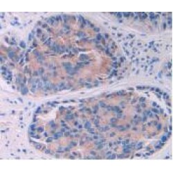 Interleukin 10 Receptor Alpha (IL10Ra) Antibody