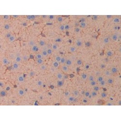 Interleukin 11 Receptor Alpha (IL11Ra) Antibody