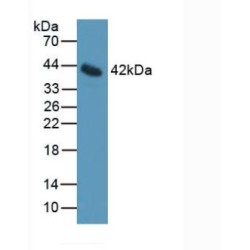 Interleukin 11 Receptor Alpha (IL11Ra) Antibody