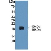 Western blot analysis of recombinant Mouse IL11Ra.