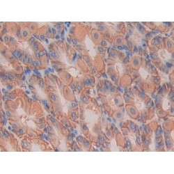 Interleukin 11 Receptor Alpha (IL11Ra) Antibody