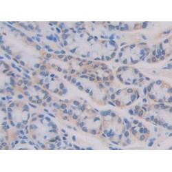 Interleukin 11 Receptor Alpha (IL11Ra) Antibody