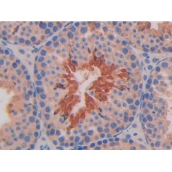 Interleukin 11 Receptor Alpha (IL11Ra) Antibody