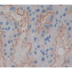 Melanoma Cell Adhesion Molecule (MCAM) Antibody