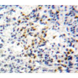 Growth-Regulated Alpha Protein / GROA (CXCL1) Antibody