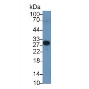 Western blot analysis of Human Serum, using Human PEX2 Antibody (1 µg/ml) and HRP-conjugated Goat Anti-Rabbit antibody (<a href="https://www.abbexa.com/index.php?route=product/search&amp;search=abx400043" target="_blank">abx400043</a>, 0.2 µg/ml).