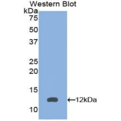 Peroxisomal Biogenesis Factor 2 (PEX2) Antibody