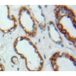 Peroxisomal Biogenesis Factor 2 (PEX2) Antibody