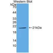 Western blot analysis of the recombinant protein.