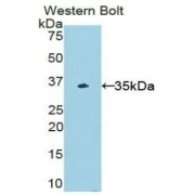 Western blot analysis of the recombinant protein.