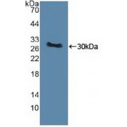 Serine/Threonine-Protein Kinase PINK1, Mitochondrial (PINK1) Antibody