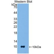 Western blot analysis of the recombinant protein.