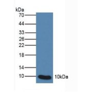 Western blot analysis of Human Leukocyte Cells.