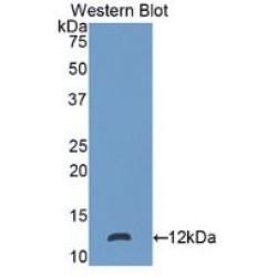 S100 Calcium Binding Protein P (S100P) Antibody