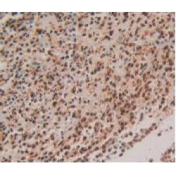 S100 Calcium Binding Protein P (S100P) Antibody