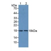 Western blot analysis of (1) Human Liver Tissue and (2) Human Lung Tissue.