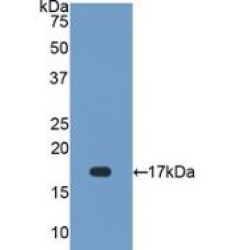 Superoxide Dismutase 1 (SOD1) Antibody