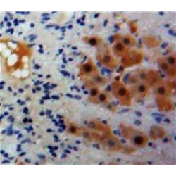 Superoxide Dismutase 1 (SOD1) Antibody