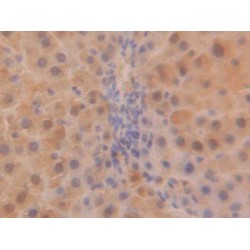 Superoxide Dismutase 1 (SOD1) Antibody