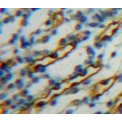 Superoxide Dismutase 1 (SOD1) Antibody