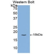 Western blot analysis of recombinant Human TFPI.