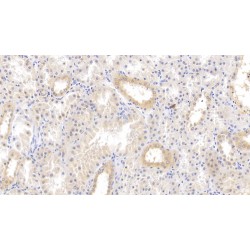 Tissue Factor Pathway Inhibitor (TFPI) Antibody