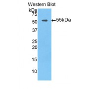 Western blot analysis of the recombinant protein.