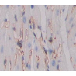 Beta-Secretase 1 (BACE1) Antibody