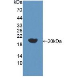 Beta-Site APP Cleaving Enzyme 2 (bACE2) Antibody