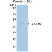 Western blot analysis of recombinant Hujman GLI3 Protein.