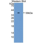 Western blot analysis of recombinant Mouse GLI3.