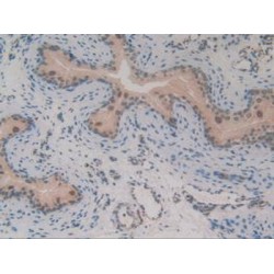 GLI Family Zinc Finger Protein 3 (GLI3) Antibody