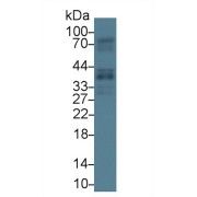 Western blot analysis of Human Lung lysate, using Human GAS2 Antibody (1 µg/ml) and HRP-conjugated Goat Anti-Rabbit antibody (<a href="https://www.abbexa.com/index.php?route=product/search&amp;search=abx400043" target="_blank">abx400043</a>, 0.2 µg/ml).