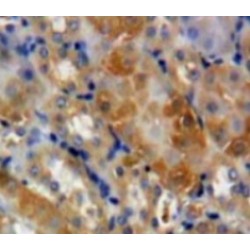 Growth Arrest Specific Protein 2 (GAS2) Antibody