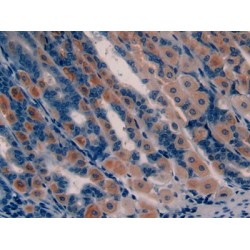 Somatoliberin (GHRH) Antibody