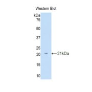 Western blot analysis of the recombinant protein.