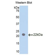 Western blot analysis of the recombinant protein.