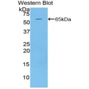 Western blot analysis of the recombinant protein.