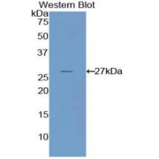 Western blot analysis of the recombinant protein.