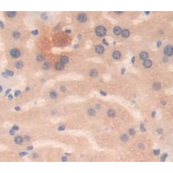 Nicotinamide-N-Methyltransferase (NNMT) Antibody