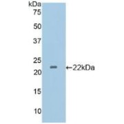 Western blot analysis of recombinant Mouse CD36.