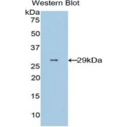 Western blot analysis of recombinant Rat CD36 Protein.