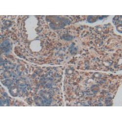 Protein C Receptor, Endothelial (PROCR) Antibody