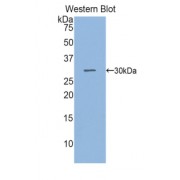 Western blot analysis of recombinant Human SGPL1.