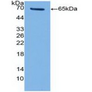 Western blot analysis of recombinant Human TERT.