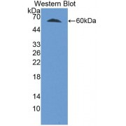 Western blot analysis of the recombinant protein.