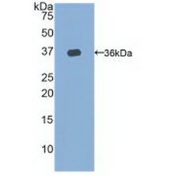 Telomerase Reverse Transcriptase (TERT) Antibody