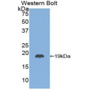 Western blot analysis of the recombinant protein.