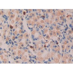 Transforming Growth Factor Alpha (TGFA) Antibody